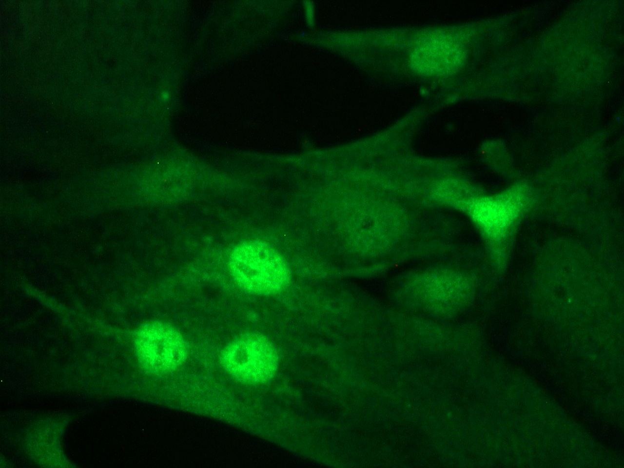 Figure 4. MyoD1 immunostaining of nuclei in MyoD1 transfected cells induced to undergo muscle cell differentiation.